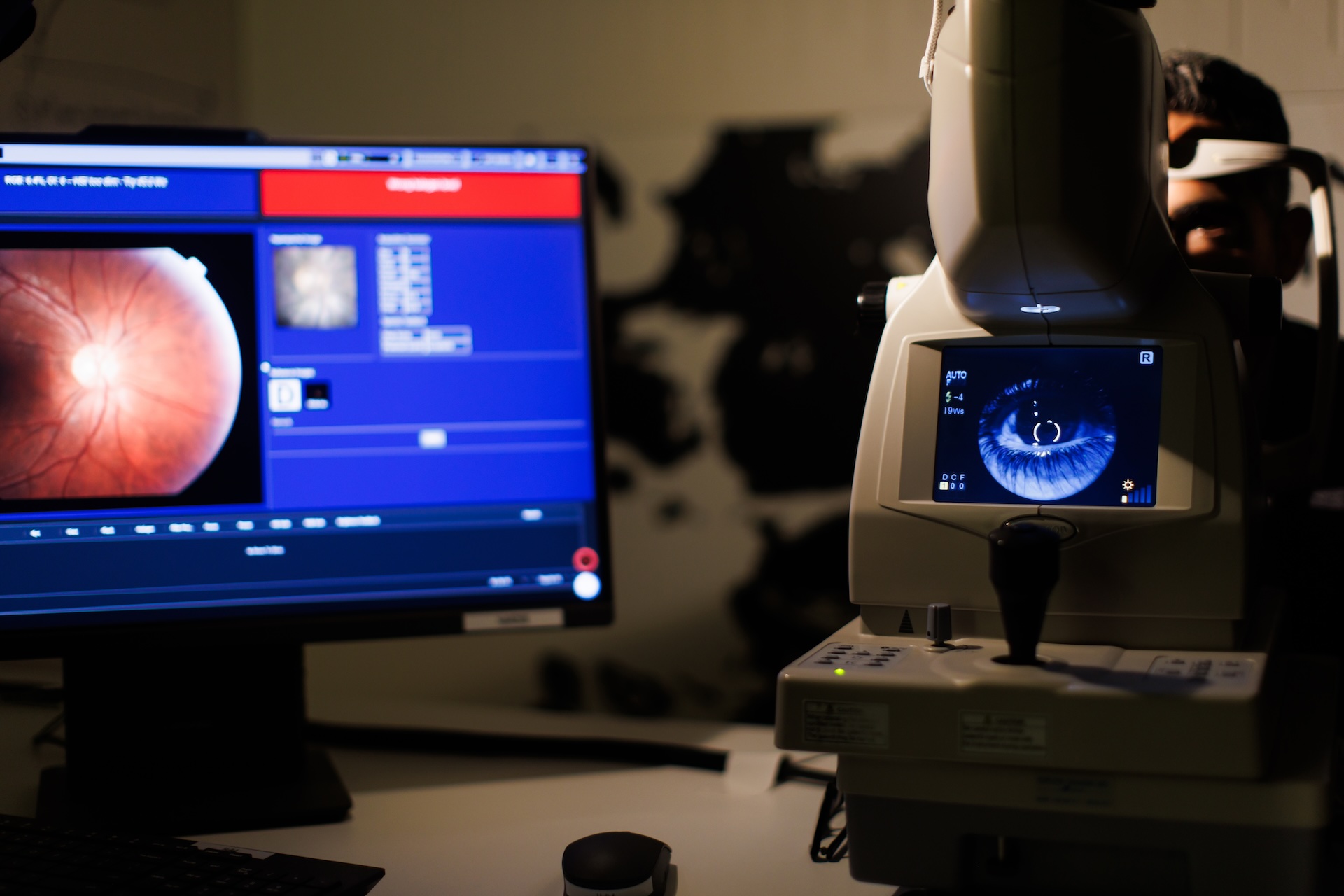 A person undergoing an eye exam using optical imaging equipment. A computer monitor displays a detailed image of an eye's retina.